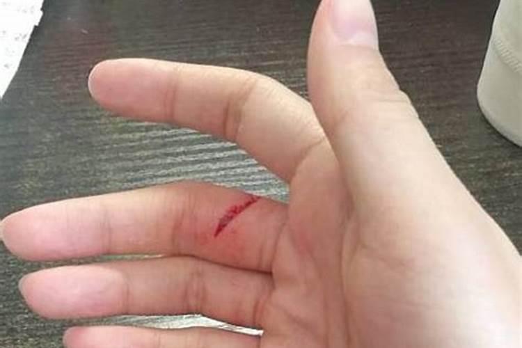 冬至养生保健的方法