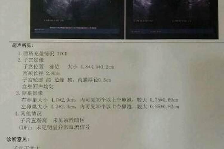 怎样让堕胎儿再来投胎