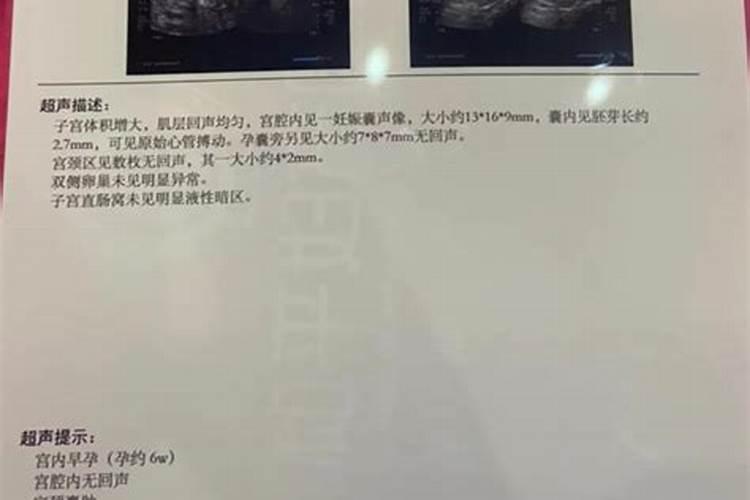 堕胎的果报与化解方法