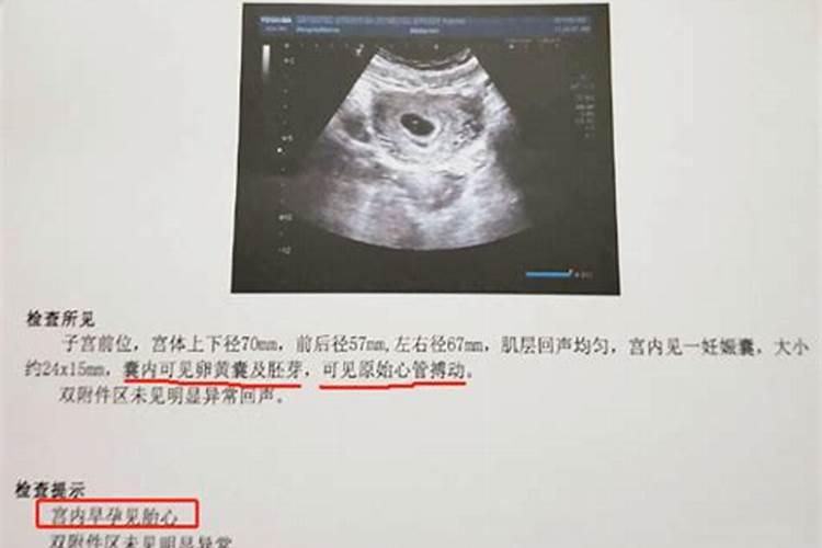 堕胎的胎儿有灵魂吗  百度宝宝知道