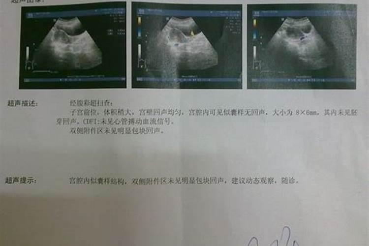 八字合婚怎么看？读这篇就够了!