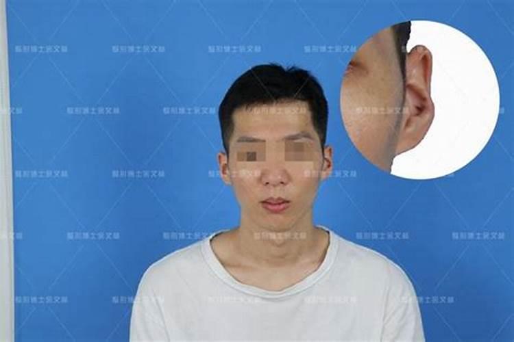 男人耳朵反骨有福吗？