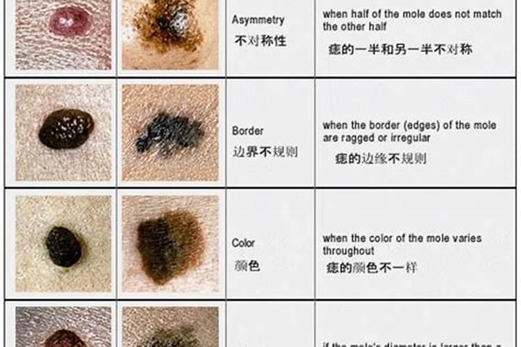 己巳年,甲戌月,丙辰日,戊戌时？