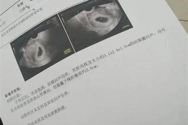 40天的孕囊算是生命吗 孕早期要做什么检查