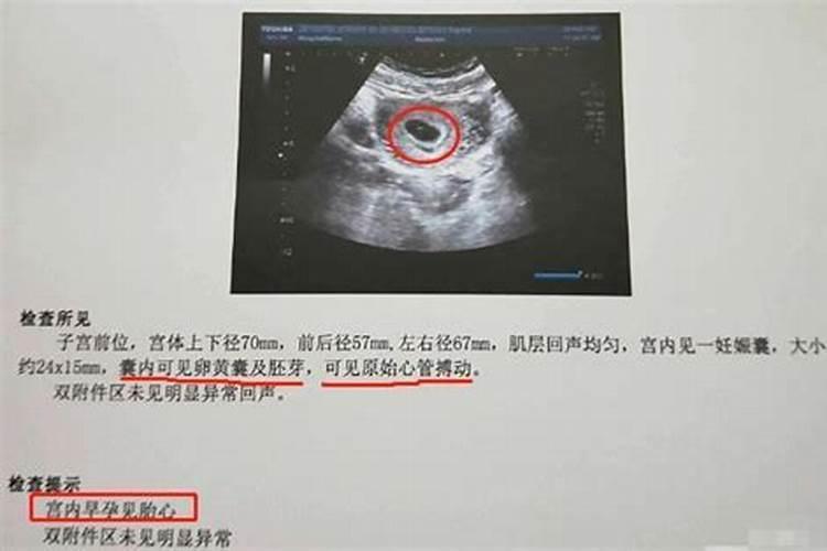 40天孕囊算生命了吗 受精卵着床的感觉有什么