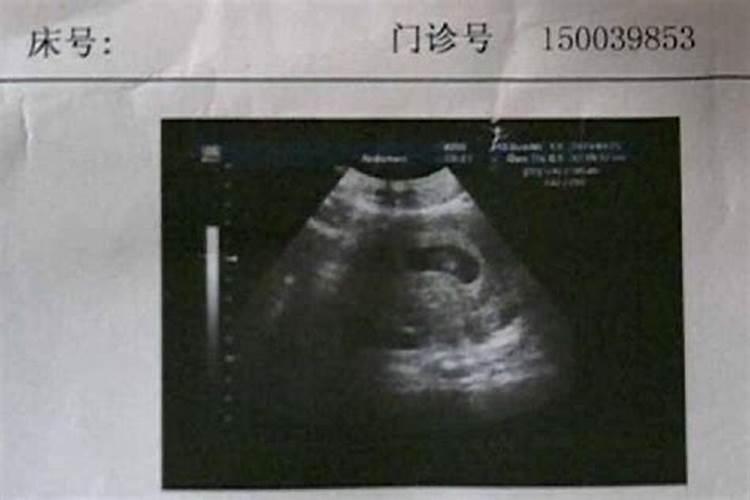 堕胎四次还可以怀孕吗？堕胎四次还能生育吗？