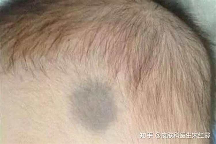 童子煞身上三个标志