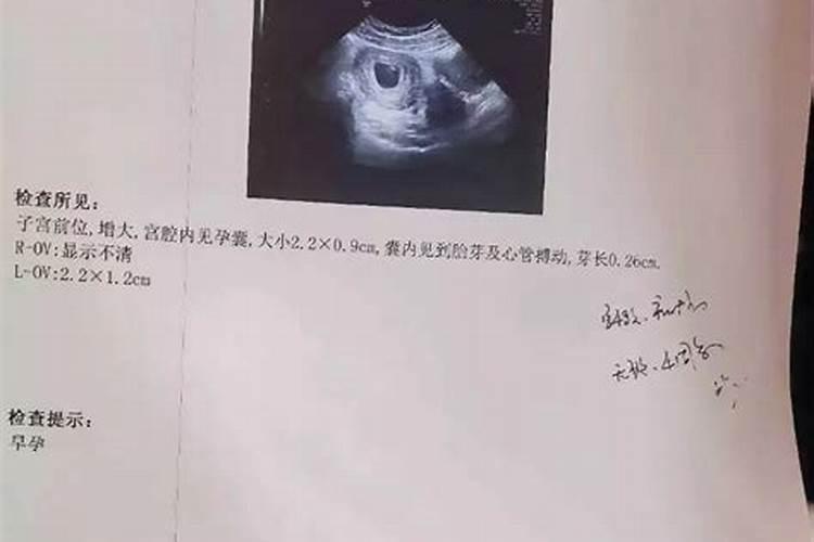 堕胎之后孩子真的会变婴灵吗？
