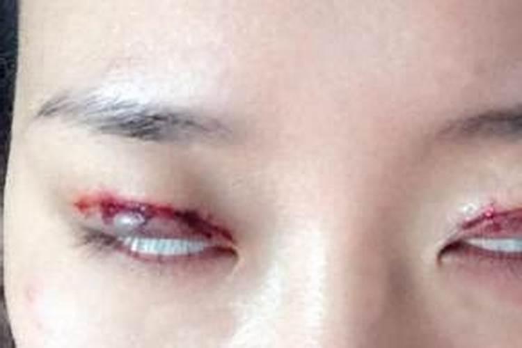 有些人死了眼睛怎么没有闭上呢？
