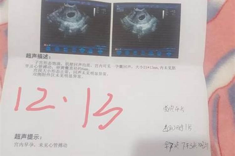 梦见去世的母亲流眼泪的预兆