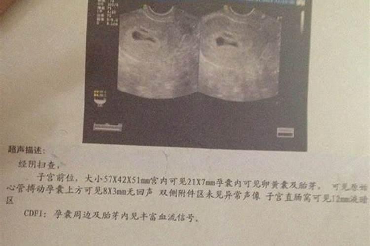 引掉的那个孩子和我现在儿子一天生日